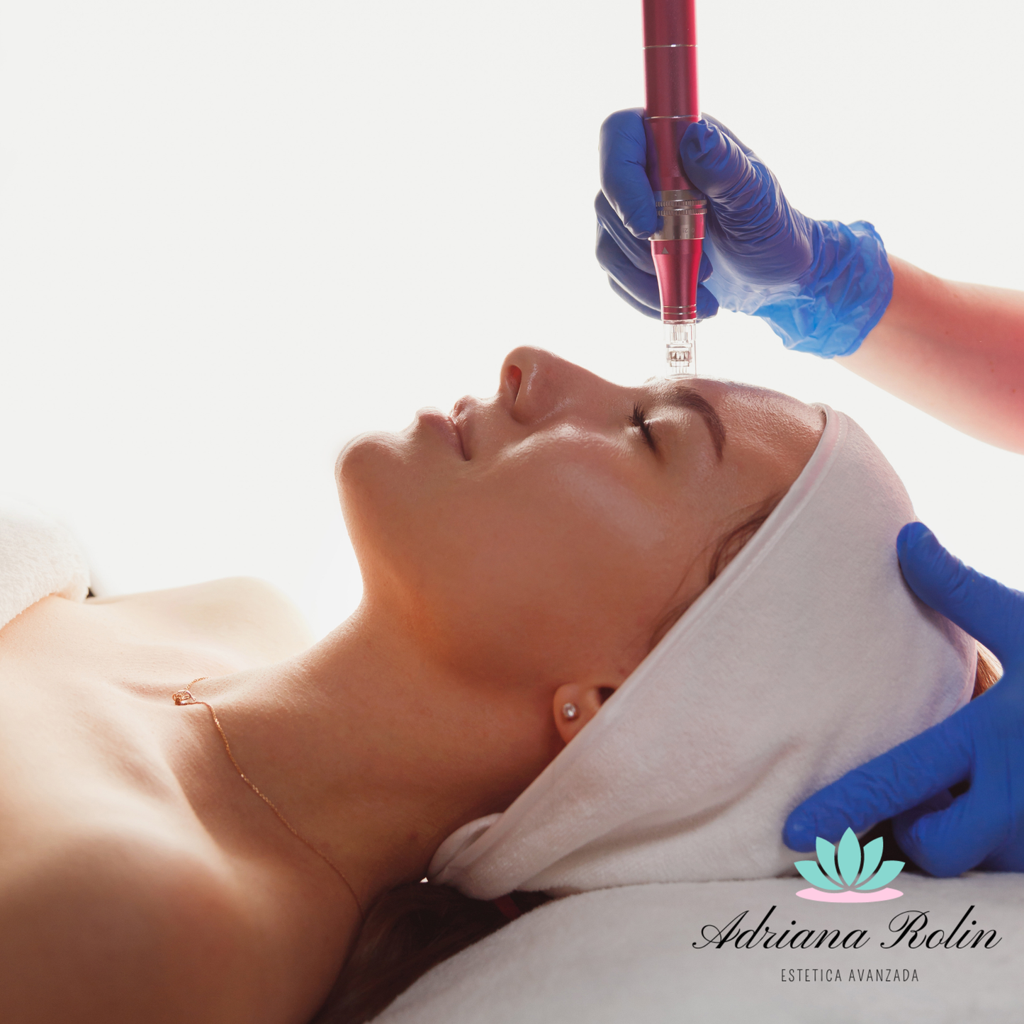 Biorrevitalización con Dermapen