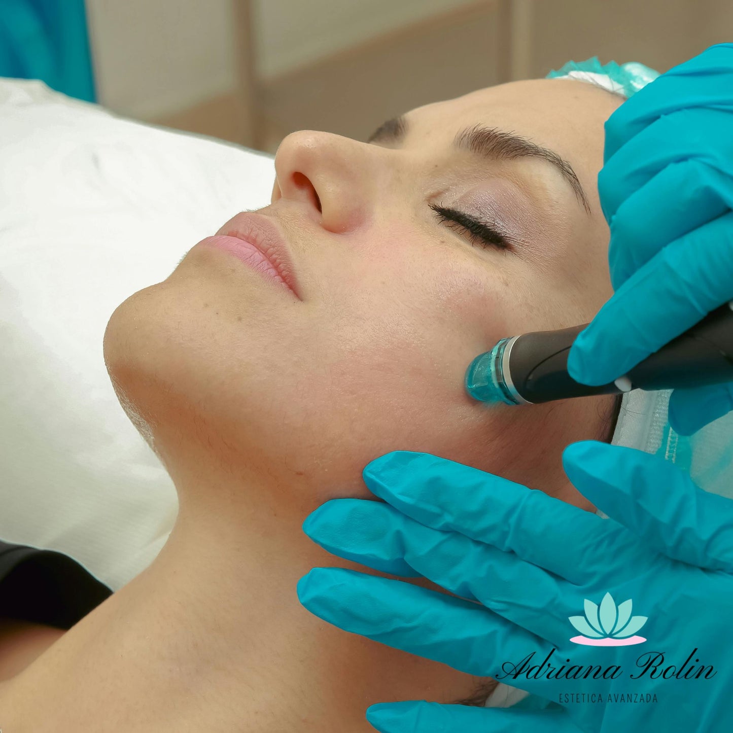 Hidrafacial