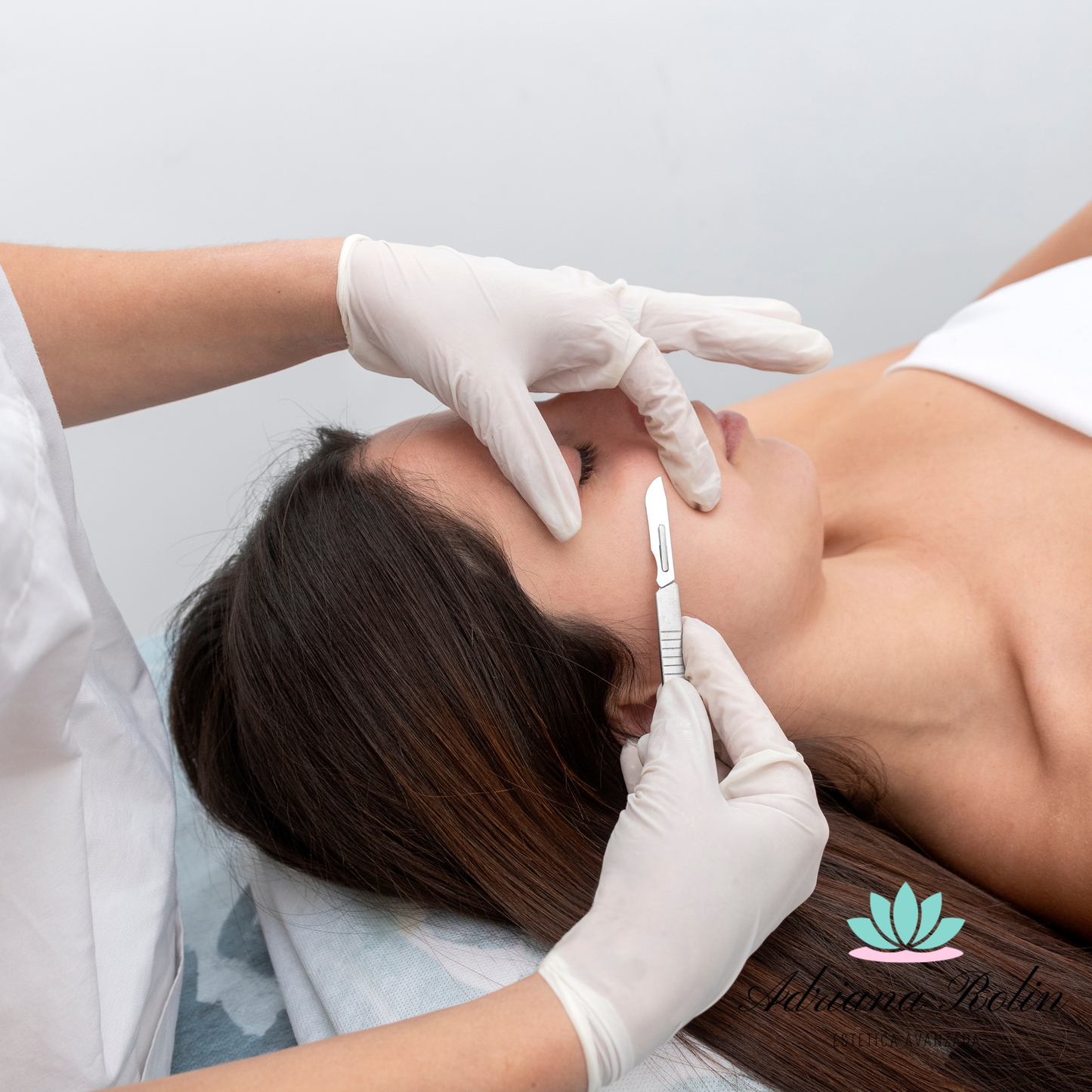 Dermaplaning