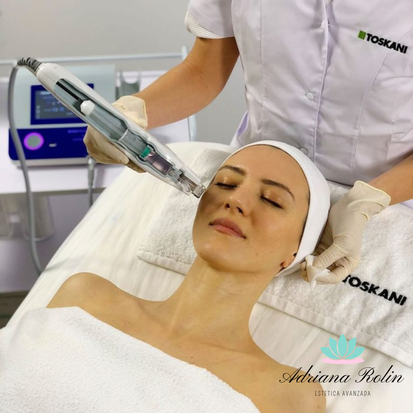 Mesoterapia Facial
