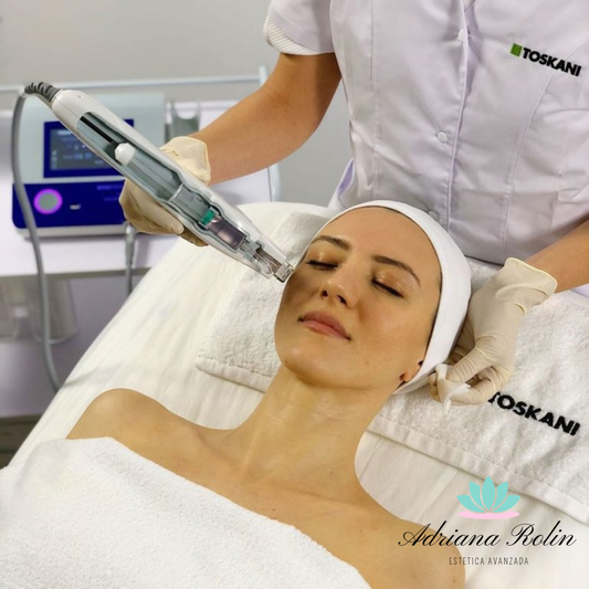 Mesoterapia Facial