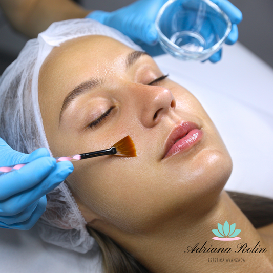 Peeling Químico Facial