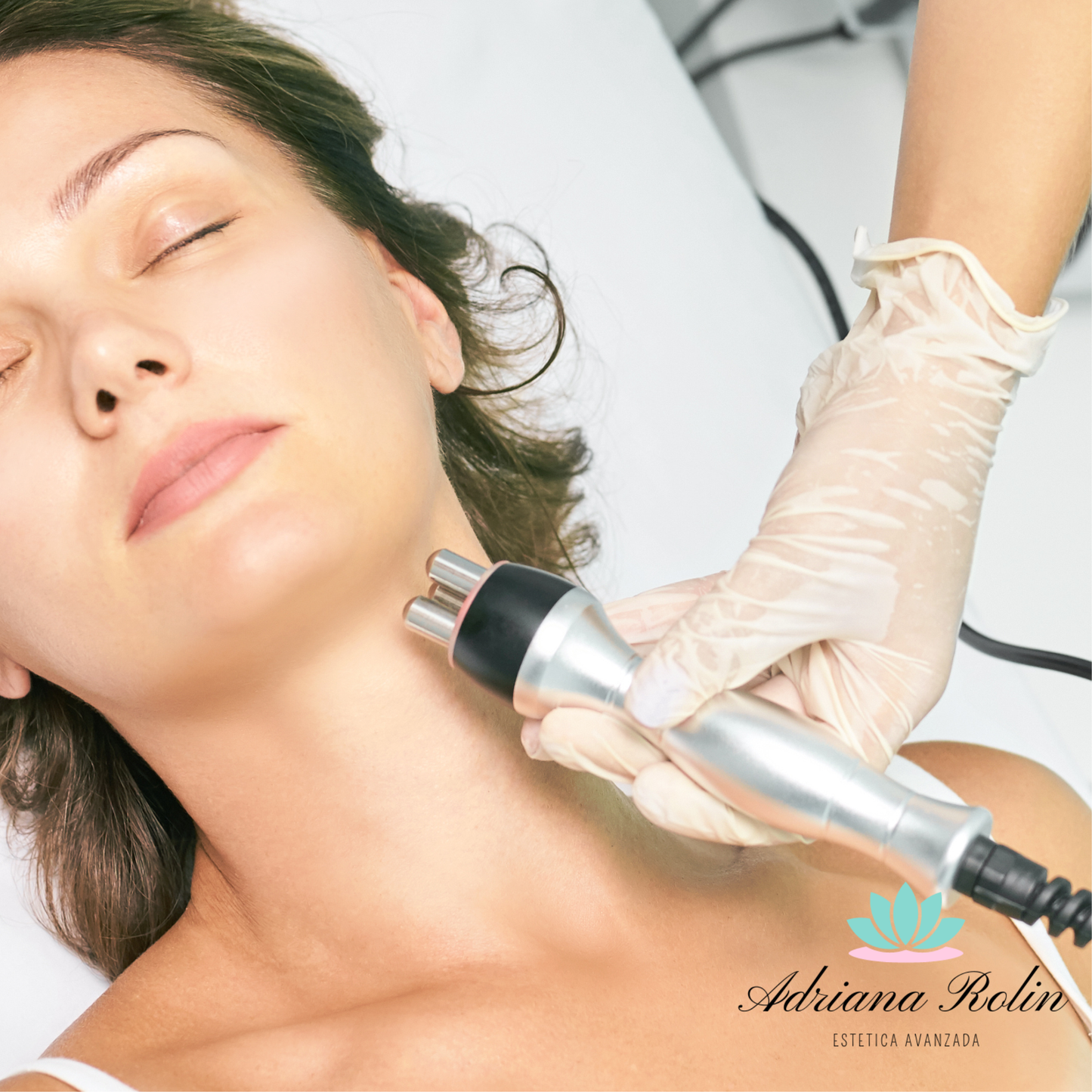 Radiofrecuencia Cara y Cuello